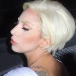 Lady Gaga lộ diện sau phẫu thuật
