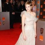 Emma Watson - vịt xấu xí hóa thành thiên nga